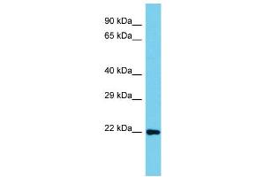 Host: Rabbit Target Name: C8orf33 Sample Type: Jurkat Whole Cell lysates Antibody Dilution: 1. (C8orf33 antibody  (C-Term))
