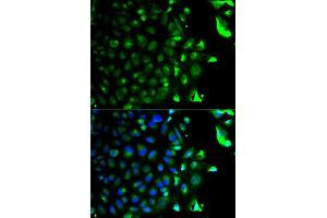 Immunofluorescence analysis of HeLa cells using RAB5A antibody (ABIN5970526). (RAB5 antibody)