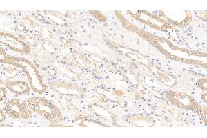 Detection of GSTM1 in Human Kidney Tissue using Polyclonal Antibody to Glutathione S Transferase Mu 1 (GSTM1) (GSTM1 antibody  (AA 1-218))