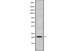 Western blot analysis of RABL5 using A549 whole cell lysates (RABL5 antibody  (Internal Region))