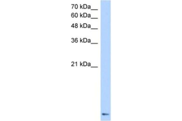 ZNF706 antibody