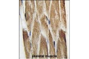 Formalin-fixed and paraffin-embedded human skeletal muscle tissue reacted with DCX Antibody  (ABIN389254 and ABIN2839395) , which was peroxidase-conjugated to the secondary antibody, followed by DAB staining. (Doublecortin antibody  (AA 107-137))