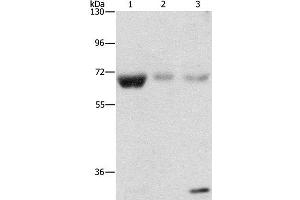 Western Blot analysis of Human fetal muscle, kidney and liver tissue using NAE1 Polyclonal Antibody at dilution of 1:500 (NAE1 antibody)