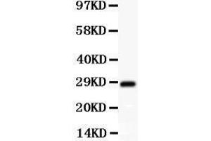 Anti-SCP3 Picoband antibody,  All lanes: Anti SCP3  at 0. (SYCP3 antibody  (AA 18-223))