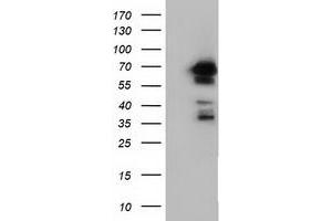 Western Blotting (WB) image for anti-Adenylate Kinase 5 (AK5) antibody (ABIN1496533)