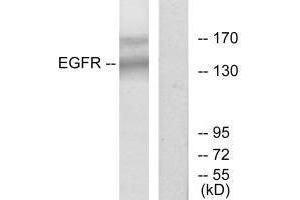 Western blot analysis of extracts from HT-29 cells, using EGFR (Ab-1172) antibody. (EGFR antibody  (Tyr1172))