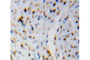 Used in DAB staining on fromalin fixed paraffin-embedded Brain tissue (HSPH1 antibody  (AA 388-505))