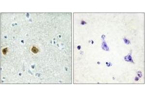 Immunohistochemistry (IHC) image for anti-NADH Dehydrogenase (Ubiquinone) 1, Subcomplex Unknown, 2, 14.5kDa (NDUFC2) (AA 51-100) antibody (ABIN2889359) (NDUFC2 antibody  (AA 51-100))
