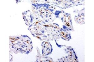 IHC-F testing of human placenta tissue (HSD17B2 antibody  (AA 373-387))