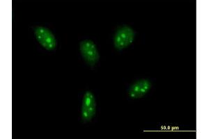 Immunofluorescence of purified MaxPab antibody to DDX24 on HeLa cell. (DDX24 antibody  (AA 1-804))