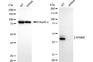 Western blotting analysis using NFKBIE antibody (ABIN7799644).