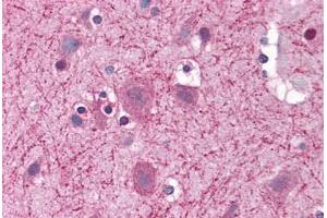 Human Brain, Cortex: Formalin-Fixed, Paraffin-Embedded (FFPE) (CCT2 antibody  (AA 277-473))