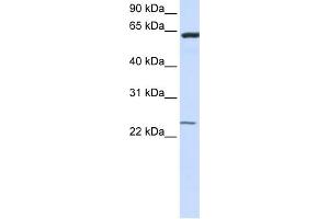 WB Suggested Anti-TMEM138 Antibody Titration:  0. (TMEM138 antibody  (N-Term))