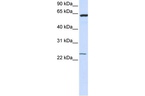 TMEM138 抗体  (N-Term)