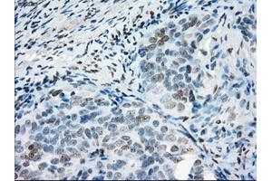 Immunohistochemical staining of paraffin-embedded colon tissue using anti-PRKYmouse monoclonal antibody. (PRKY antibody)
