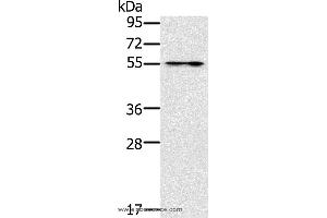 Western blot analysis of Mouse intestinum tenue tissue, using PUS10 Polyclonal Antibody at dilution of 1:200 (PUS10 antibody)