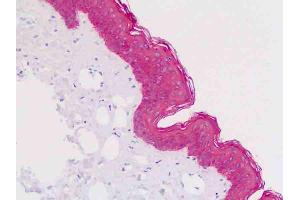 Anti-KRT5 / CK5 / Cytokeratin 5 antibody IHC staining of human skin, epidermis. (Cytokeratin 5 antibody  (AA 158-272))