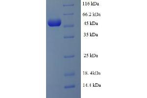 SUPT3H/SPT3 Protein (AA 1-328, Isoform 3) (His-SUMO Tag)