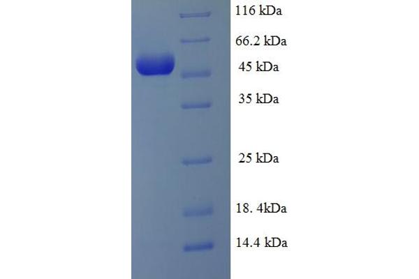 SUPT3H/SPT3 Protein (AA 1-328, Isoform 3) (His-SUMO Tag)