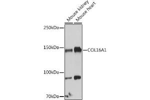 Western blot analysis of extracts of various cell lines, using COL16 antibody (8837) at 1:1000 dilution.
