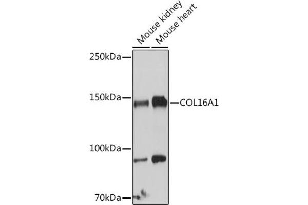 COL16A1 抗体  (AA 1000-1100)