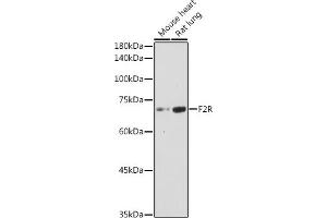 Western blot analysis of extracts of various cell lines, using F2R antibody (ABIN6132223, ABIN6140404, ABIN6140405 and ABIN6221279) at 1:1000 dilution. (PAR1 antibody  (AA 42-110))
