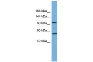 Image no. 1 for anti-Phosphatidylinositol 4-Kinase, Catalytic, beta (PI4KB) (AA 755-804) antibody (ABIN6745689) (PI4KB antibody  (AA 755-804))