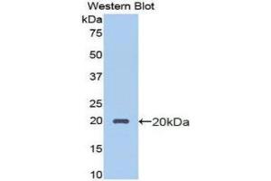 Western Blotting (WB) image for anti-Protein C Receptor, Endothelial (PROCR) (AA 63-205) antibody (ABIN1172000)