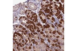Immunohistochemical staining of human stomach with ETFDH polyclonal antibody  shows strong cytoplasmic positivity in glandular cells. (ETFDH antibody)
