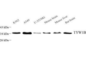 Western blot analysis of TYW1B (ABIN7076025) at dilution of 1: 3000 (TYW1B antibody)