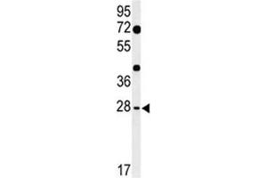 Western blot analysis of HES7 antibody and mouse heart tissue lysate. (HES7 antibody  (AA 26-55))
