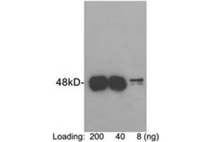 Loading: Protein C tag fusion protein expressed in E. (Protein C Tag antibody)