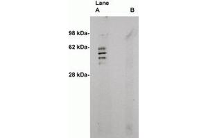 Image no. 1 for anti-Sphingomyelin Synthase 2 (SGMS2) antibody (ABIN793628) (Sphingomyelin Synthase 2 antibody)