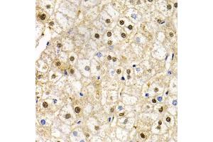 Immunohistochemistry of paraffin-embedded human liver injury using RAD9A antibody. (RAD9A antibody)