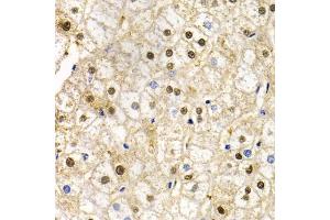 Immunohistochemistry of paraffin-embedded human liver injury using RAD9A antibody. (RAD9A antibody)