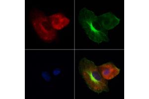 ABIN7094114 and ABIN7098158 staining Hela cells by IF/ICC. (Cathepsin L antibody  (Internal Region))