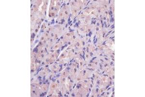 Immunohistochemistry (Paraffin-embedded Sections) (IHC (p)) image for anti-Eukaryotic Translation Initiation Factor 4E Family Member 2 (EIF4E2) antibody (ABIN650677)