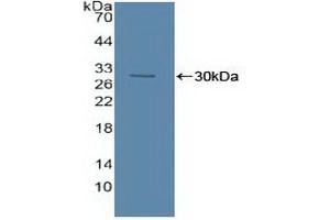 Western blot analysis of recombinant Human ASM. (SMPD1 antibody  (AA 319-579))