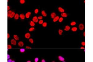 Immunofluorescence analysis of HeLa cells using SFPQ Polyclonal Antibody at dilution of 1:100 (40x lens). (SFPQ antibody)