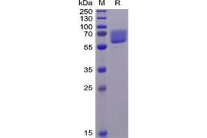 Human AXL Protein, His Tag on SDS-PAGE under reducing condition. (AXL Protein (His tag))