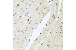 Immunohistochemistry of paraffin-embedded mouse heart using PNKP antibody (ABIN2564598) at dilution of 1:100 (40x lens). (PNKP antibody)