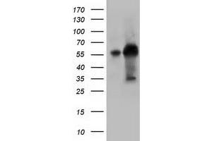 HEK293T cells were transfected with the pCMV6-ENTRY control (Left lane) or pCMV6-ENTRY KLHL2 (Right lane) cDNA for 48 hrs and lysed. (KLHL2 antibody  (AA 1-100, AA 494-593))