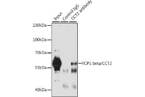 Immunoprecipitation analysis of 200 μg extracts of A-549 cells, using 3 μg TCP1 beta/TCP1 beta/CCT2 antibody (ABIN6128981, ABIN6138104, ABIN6138105 and ABIN6222212). (CCT2 antibody  (AA 206-535))