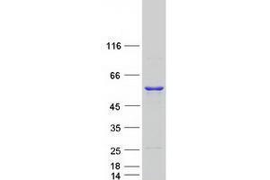 Validation with Western Blot (UAP1 Protein (Myc-DYKDDDDK Tag))