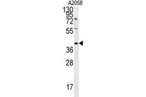 Western Blotting (WB) image for anti-CD99 Molecule-Like 2 (CD99L2) antibody (ABIN3002368) (CD99L2 antibody)