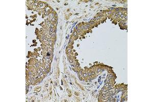Immunohistochemistry of paraffin-embedded human prostate using MTIF3 antibody. (MTIF3 antibody)