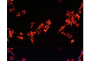 Immunofluorescence analysis of NIH/3T3 cells using PGRMC2 Polyclonal Antibody at dilution of 1:100. (PGRMC2 antibody)
