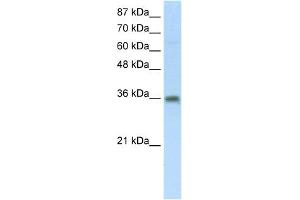 WB Suggested Anti-SFRS10 Antibody Titration:  5. (TRA2B antibody  (Middle Region))