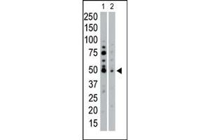 The anti-SGK2 Pab (ABIN1882131 and ABIN2842048) is used in Western blot to detect SGK2 in HeLa cell lysate (Lane 1) and mouse pancreas tissue lysate (Lane 2). (SGK2 antibody  (N-Term))