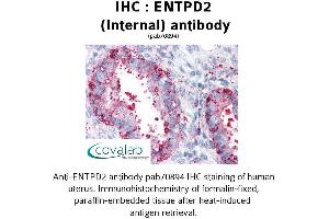 Image no. 2 for anti-Ectonucleoside Triphosphate diphosphohydrolase 2 (ENTPD2) (Internal Region) antibody (ABIN1734055)